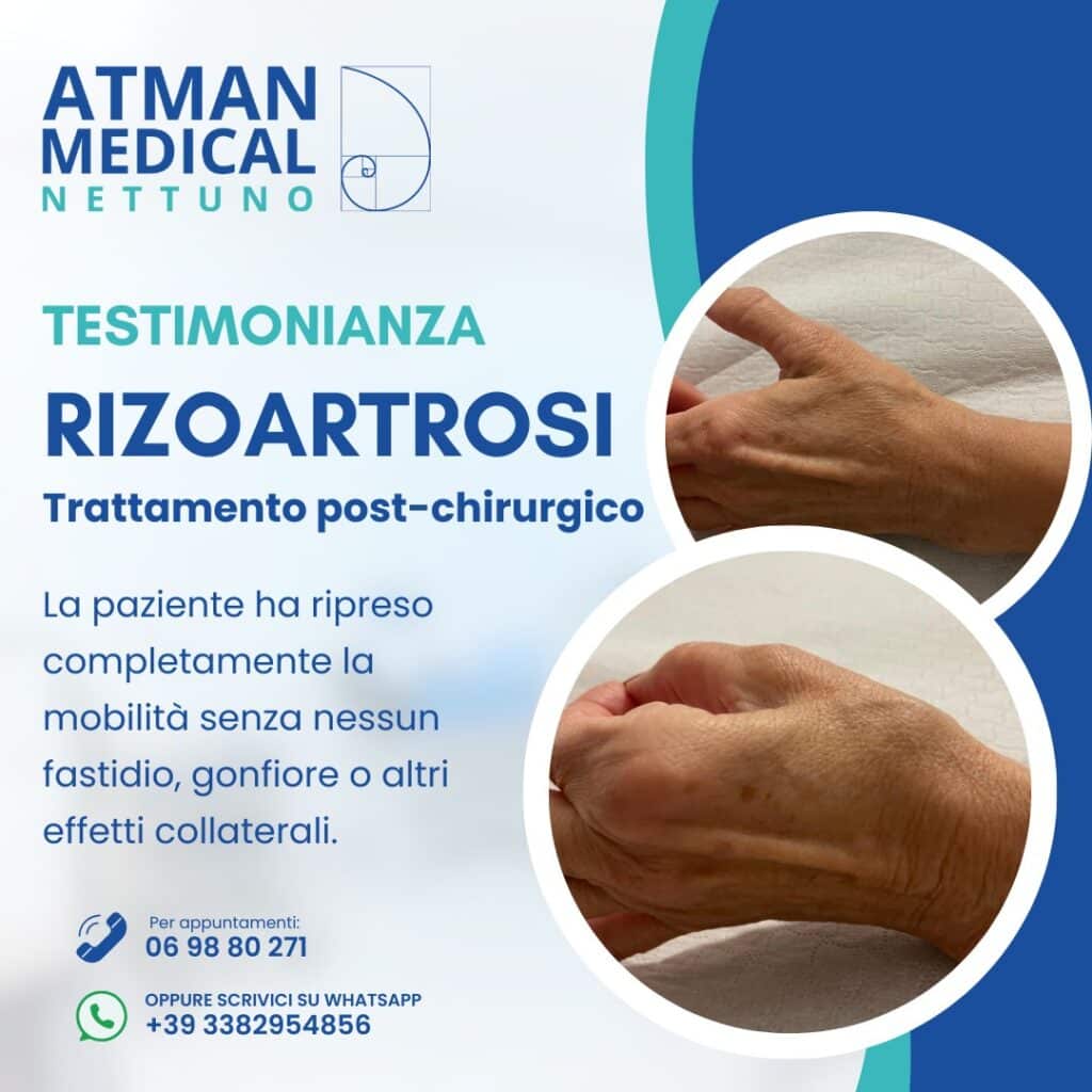 rizoartrosi